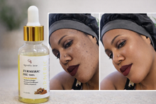 Load image into Gallery viewer, Turmeric oil Serum
